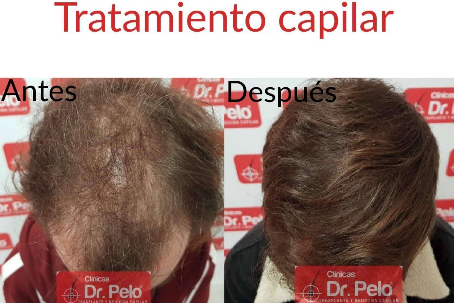 Las Clínicas Dr. Pelo disponen de todo tipo de tratamientos capilares