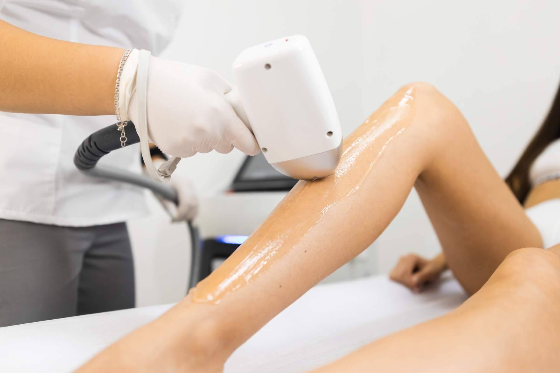 Dermativa ofrece servicio de depilación facial definitiva