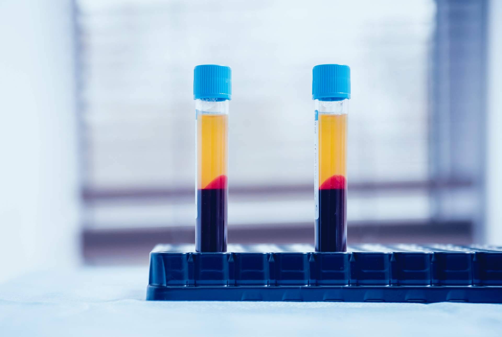 El papel del plasma rico en plaquetas en la traumatología